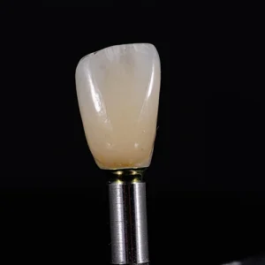 Coroa de zirconia sobre implante (2)