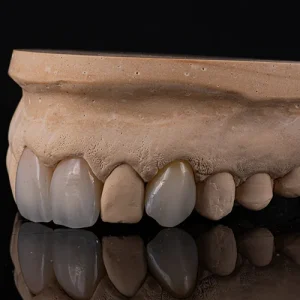 Coroa zirconia sobre dente (2)