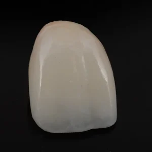 Coroa zirconia sobre dente (5)