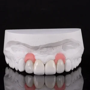 Facetas