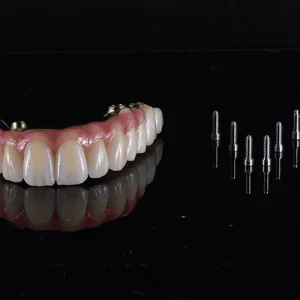 Ponte Total Zirconia sobre implantes (1)