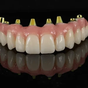 Ponte Total Zirconia sobre implantes (2)