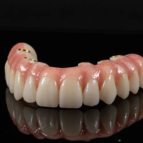 Ponte Total Zirconia sobre implantes (3)