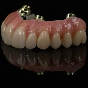 Ponte Total Zirconia sobre implantes (5)
