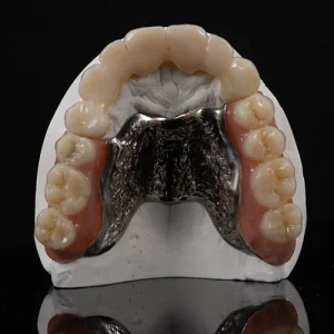 Ponte Zirconia com attachment (2)