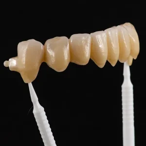 Ponte Zirconia com attachment (3)