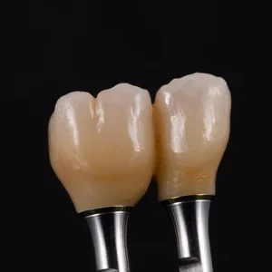 Ponte Zirconia sobre implantes (2)