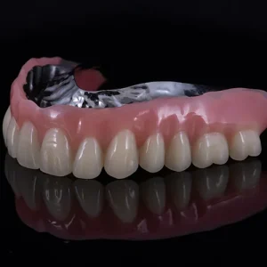 Overdenture