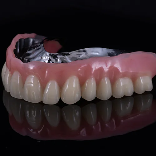 Overdenture