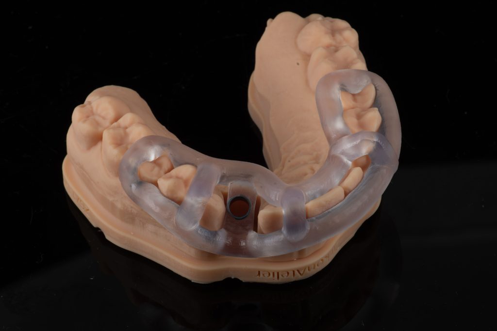 Guia posicionamento de implantes (2)